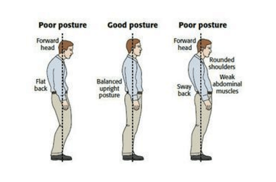 Джерело зображення: http://www.thephysiocompany.com/blog/stop-slouching-postural-dysfunction-symptoms-causes-and-treatment-of-bad-posture