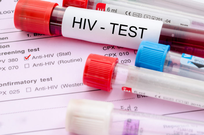 Тест на ВІЛ