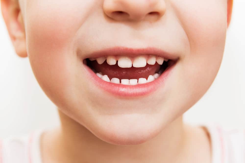 проблема молочних зубів