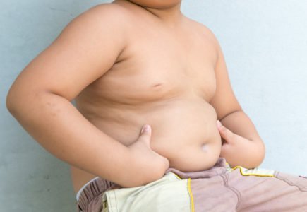 ожиріння у дітей