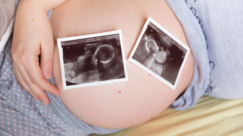 ризик вагітності з близнюками зникає