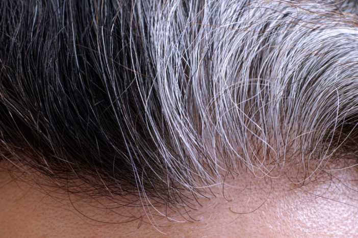 Причини появи сивистих волосся