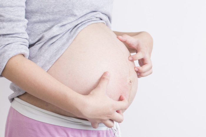 Пріритический фолікуліт є причиною свербіння шкіри під час вагітності
